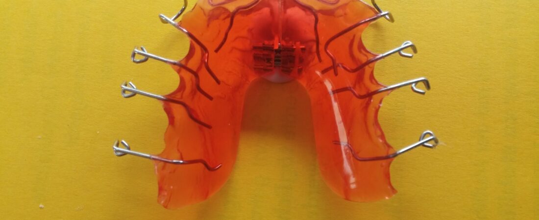 Fakty i mity dotyczące aparatów ortodontycznych