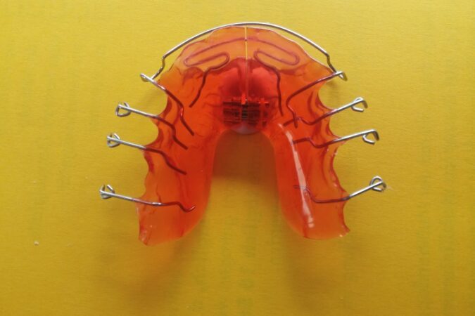Fakty i mity dotyczące aparatów ortodontycznych