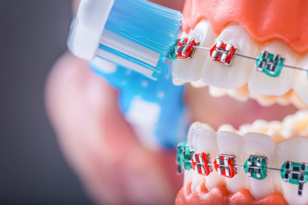Dentysta pokazujący, jaką szczoteczką myć zęby z aparatem